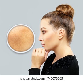 Dark spots, freckles,hyperpigmentation(melasma or chloasma)