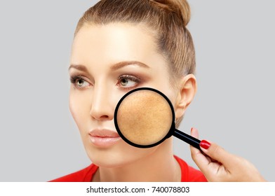 Dark spots, freckles,hyperpigmentation(melasma or chloasma)