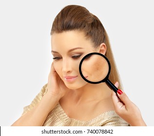 Dark spots, freckles,hyperpigmentation(melasma or chloasma)