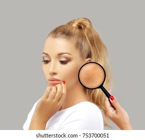 Dark spots, freckles,hyperpigmentation(melasma or chloasma)
