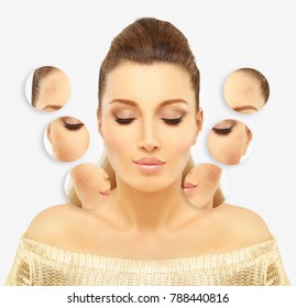 Dark spots, freckles,hyperpigmentation(melasma or chloasma)