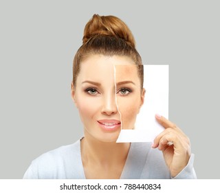 Dark spots, freckles,hyperpigmentation(melasma or chloasma)
