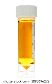 Dark Urine In A Clear, Plastic Sample Bottle