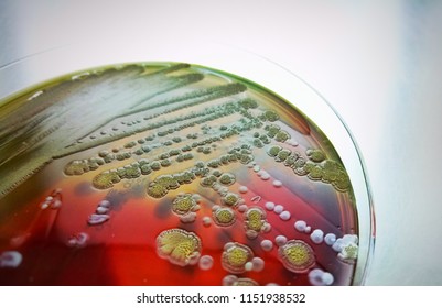 Dark yellow colonies of bacterias in hospital , blurry and selective focus 