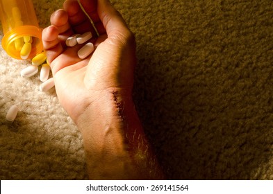 Dead man's hand with stitches where he slit his wrist and pills in his hand showing a repeated attempt at suicide which he finally succeeded at.