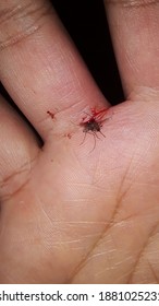 Dead Mosquito After Being Smashed With A Slap, His Blood Collection Bag Burst And Was Spread By The Murderous Hand.