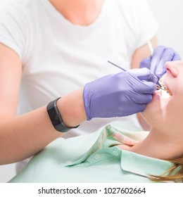 Deatail Of Young Dentists Or Dental Hygienists Hands In Ultra Violet Gloves And Black Watch Working With Dental Medical Tool And Mirror Taking Care Of A Teenage Patient With Orthodontic Braces.