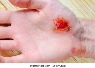 abrasion images stock photos vectors shutterstock