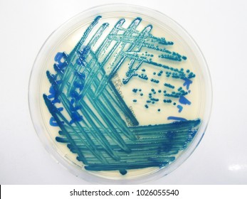 Deep Blue Colony Of Carbapenem-resistant Enterobacteriaceae (CRE).