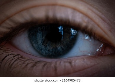 Deep Blue Eye, Reflection Of Sky And Surroundings