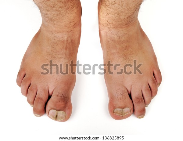 Malefeet Male Feet