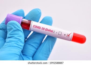 Delta variant COVID-19 positive, blood sample tube positive with delta variant or Indian strain COVID-19 