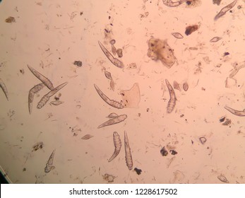 Demodex Mange From A Microscope View.