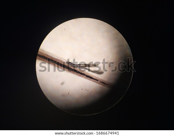 Demodex Mite Under Microscope Eyelash Hair Stock Photo 1686674941