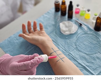 Demonstration of skin allergy testing procedure in clinic. Skin testing allergology and immunology - Powered by Shutterstock