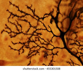 Dendritic Tree Of A Purkinje Neuron Stained With The Silver Golgi Method. The Dendrite Surface Is Full Of Small Dendritic Spines. 