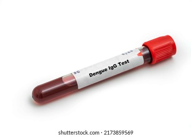 Dengue IgG Test Medical check up test tube with biological sample