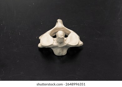 Dens of Axis Vertebra Highlighted in Bone Model