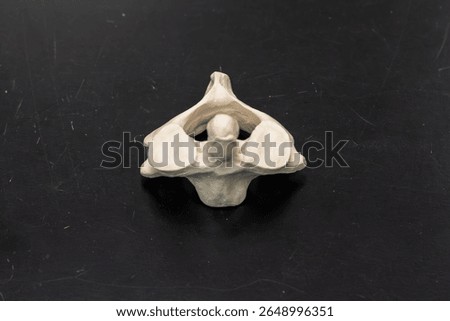 Dens of Axis Vertebra Highlighted in Bone Model