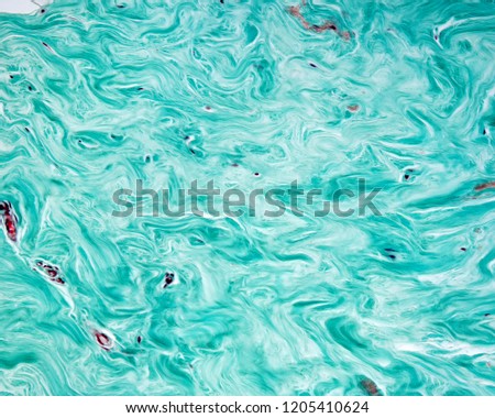 Dense connective tissue of breast interlobular stroma showing abundant fascicles of collagen fibers stained green by Gomori trichrome method. Stock photo © 