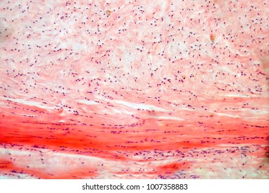 Dense Connective Tissue Microscopy Photo