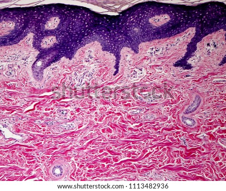 Dense irregular connective tissue of reticular dermis showing densely packed bundles of collagen fibers (stained in red). Under the epidermis (blue), the papillary dermis show a more loose tissue.