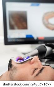Dental 3d scanner applying process. Digital impressioning teeth of patient with 3d digital dental scanner