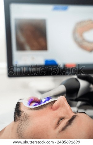 Dental 3d scanner applying process. Digital impressioning teeth of patient with 3d digital dental scanner