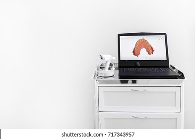 Dental 3d Scanner And Monitor In The Dentist's Office