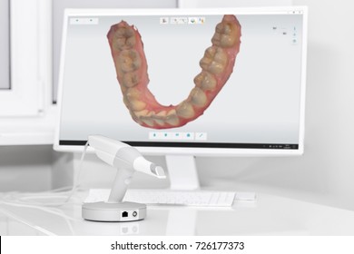 Dental 3d Scanner And Monitor In The Dentist's Office