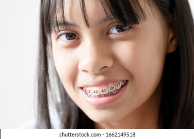 Dental Brace Girl Smiling And Looking To Camera, She Feel Happy And Have Good Attitude With Dentist.  Motivate Kids Not Fear When They Have To Go To Dental Clinic.