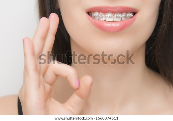 gray rubber bands braces