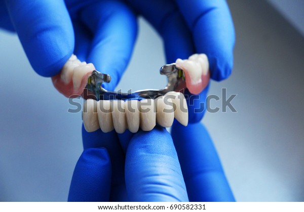 Dental
bridge