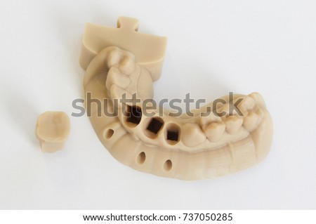 Dental bridge printed on 3D printer from a photopolymer material  on white background Stereolithography 3D printer, technology of liquid photopolymerization under UV light.