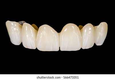 Dental ceramic bridge on isolated black background