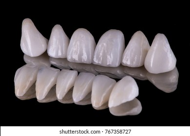 Dental Ceramic Veneers And Crowns