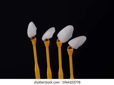 Dental ceramic veneers or porcelain laminated veneers on black background.