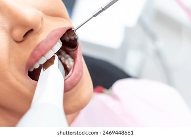 Dental clinic. Teeth examined at dentists. Healthy woman teeth and a dentist mouth mirror. Ideal teeth. Dental tools ant white tooth. Close up womans teeth with dental mirror. Dental treatment. - Powered by Shutterstock