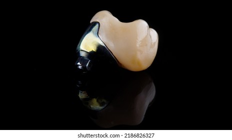 2,513 Dental crown impression Images, Stock Photos & Vectors | Shutterstock