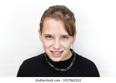 Dental Concept. Portrait Of A Pretty Teen Girl With Blond Hair And Braces On Her Teeth, The Girl Is Smiling, She Is Not Ashamed That She Has Dental Braces