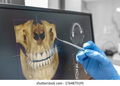 Dental consultation in clinic. Dentist showing 3D tomography image on screen
