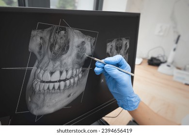 Dental consultation in clinic. Dentist showing teeth x-ray on digital tablet screen. 3D tomography technology. - Powered by Shutterstock