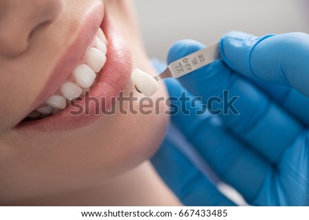 Dental crown situating near mouth of happy woman