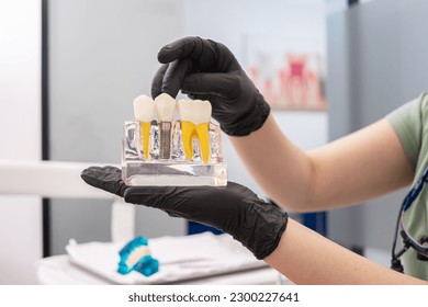 Dental expert holding human teeth model, pointing to the crown of a dental implant, and offering advice on dental implant maintenance and healthy teeth care.  - Powered by Shutterstock