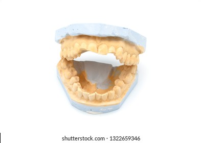 Dental Gypsum Casts Dental Model Casts Stock Photo (edit Now) 1322659352