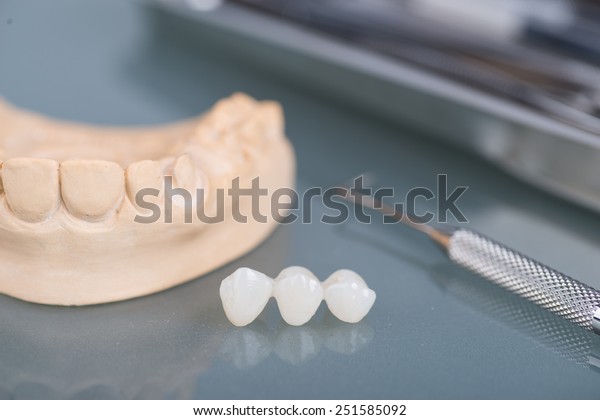 Dental gypsum models\
in dental laboratory