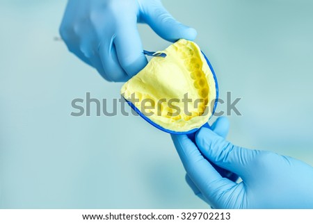 dental impression