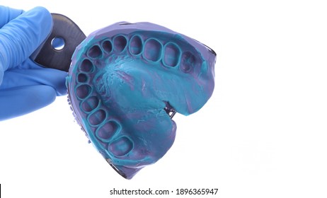 Dental Impression, Impression Material, Dental Tray.