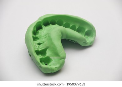 Dental Impression of Maxillary Teeth using elastomer material which consist of base and catalyst. 