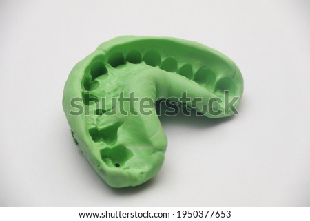 Dental Impression of Maxillary Teeth using elastomer material which consist of base and catalyst. 